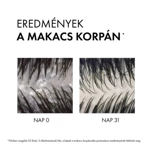 VICHY Dercos korpásodás elleni sampon száraz hajra (200 ml)