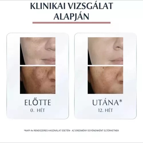 Eucerin Anti-Pigment Dual szérum (30ml)