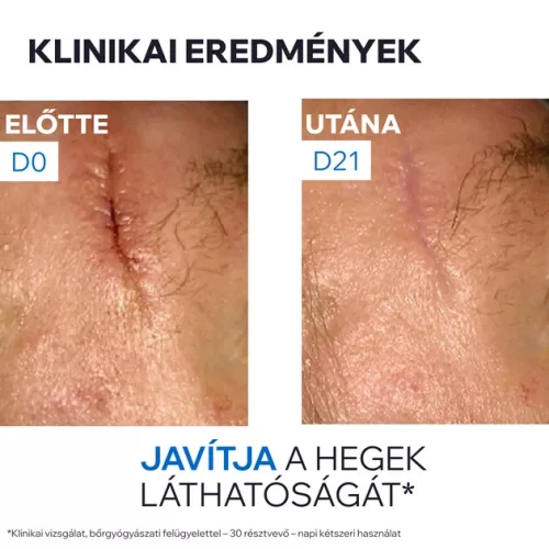 URIAGE Bariéderm Cica Cu-Zn sebkezelő krém (100ml)