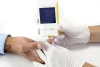 MicroINR véralvadásmérő készülék INR mérő (1db)