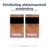 Eucerin Anti-Pigment szemránckrém (15ml)