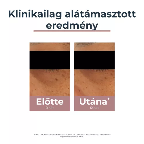 Eucerin Anti-Pigment szemránckrém (15ml)