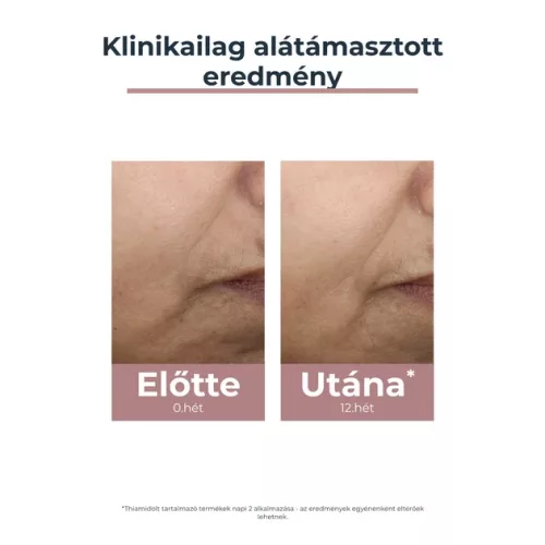 Eucerin Anti-Pigment színezett nappali arckrém medium SPF30 (50ml)