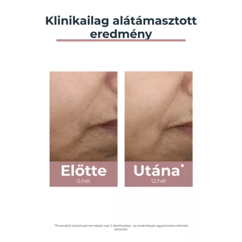 Eucerin Anti-Pigment színezett nappali arckrém light SPF30 (50ml)