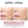 Vichy Liftactiv Pigment Specialist B3 Krém SPF50 (50ml)