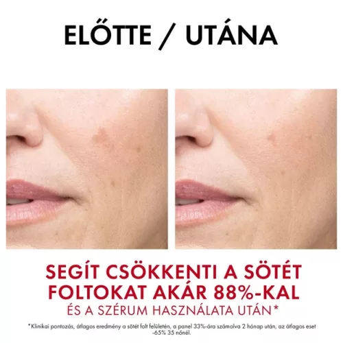 Vichy Liftactiv Pigment Specialist B3 Krém SPF50 (50ml)