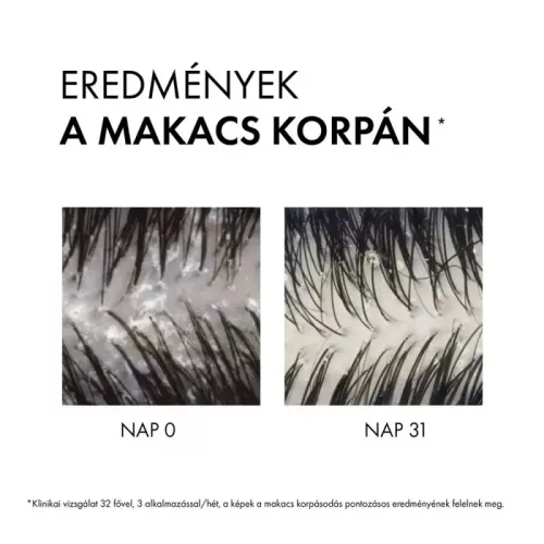 Vichy Dercos Korpásodás Elleni Sampon Utántöltő - száraz hajra (390 ml)