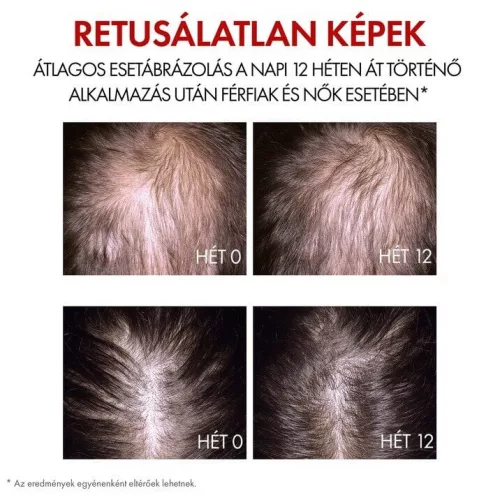 Vichy Aminexil Clinical R.E.G.E.N BOOSTER Haj Megújító Szérum (90 ml)