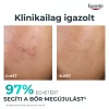Eucerin Dermopure Clinical Peeling10 BŐRMEGÚJÍTÓ SZÉRUM (40 ml)