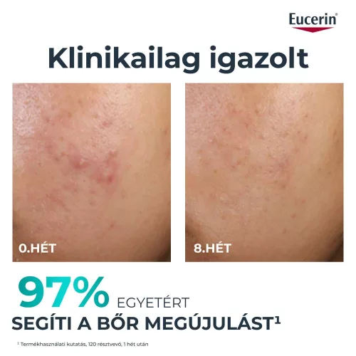 Eucerin Dermopure Clinical Peeling10 BŐRMEGÚJÍTÓ SZÉRUM (40 ml)