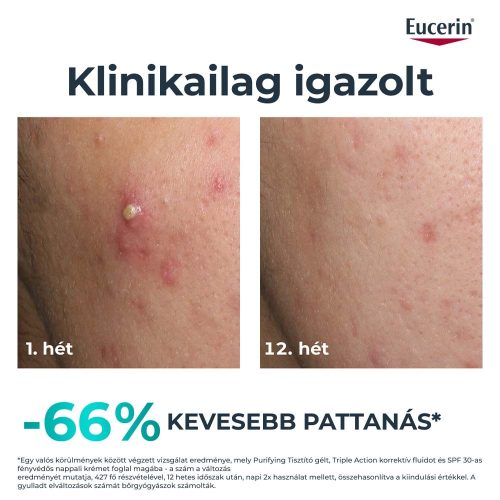 Eucerin Dermopure Clinical Triple Action korrektív fluid (40 ml)
