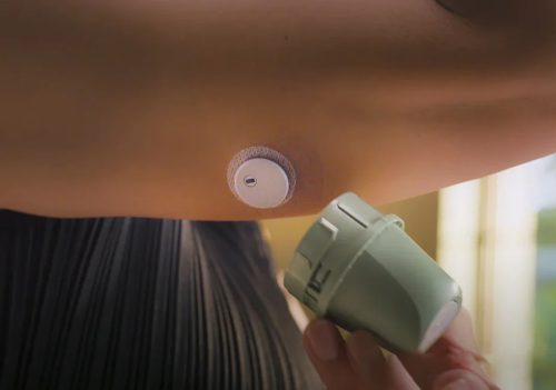 MicroTech LinX CGM folyamatos vércukorszint mérő csomag (2db)