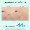 Apivita Just Be Clear szérum bőrhibák ellen (30ml)