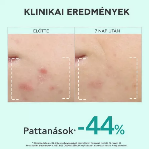 Apivita Just Be Clear szérum bőrhibák ellen (30ml)
