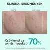 Apivita Just Be Clear szérum bőrhibák ellen (30ml)