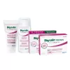 Bioscalin TricoAGE 50+ 3 havi hajerősítő csomag samponnal + ajándék kondicionáló