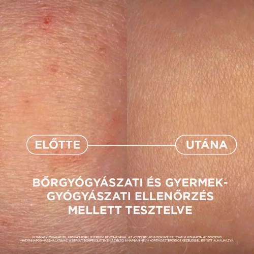 Bioderma Atoderm AD Intensive balzsam 400ml