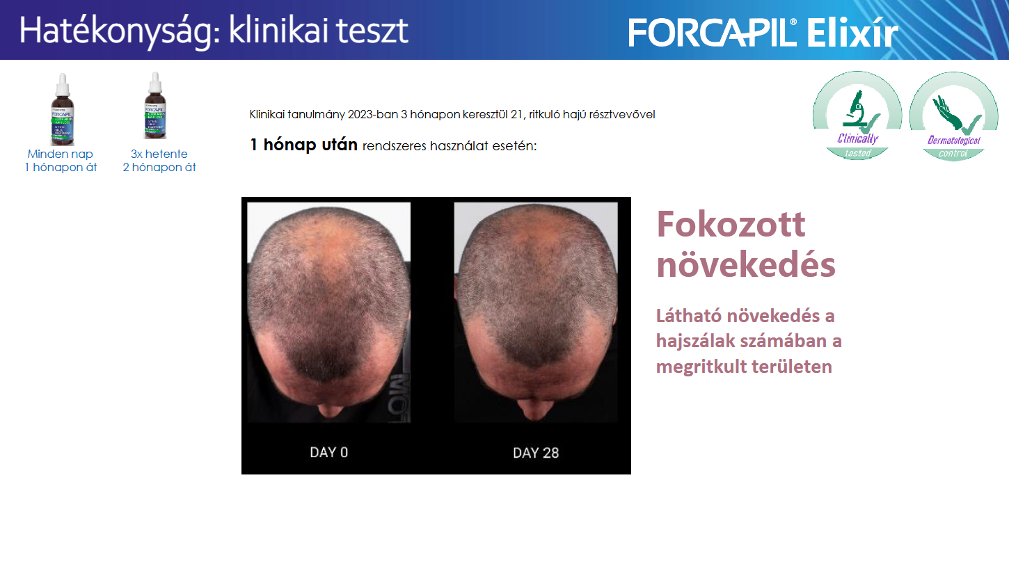 Forcapil klinikai kísérlet