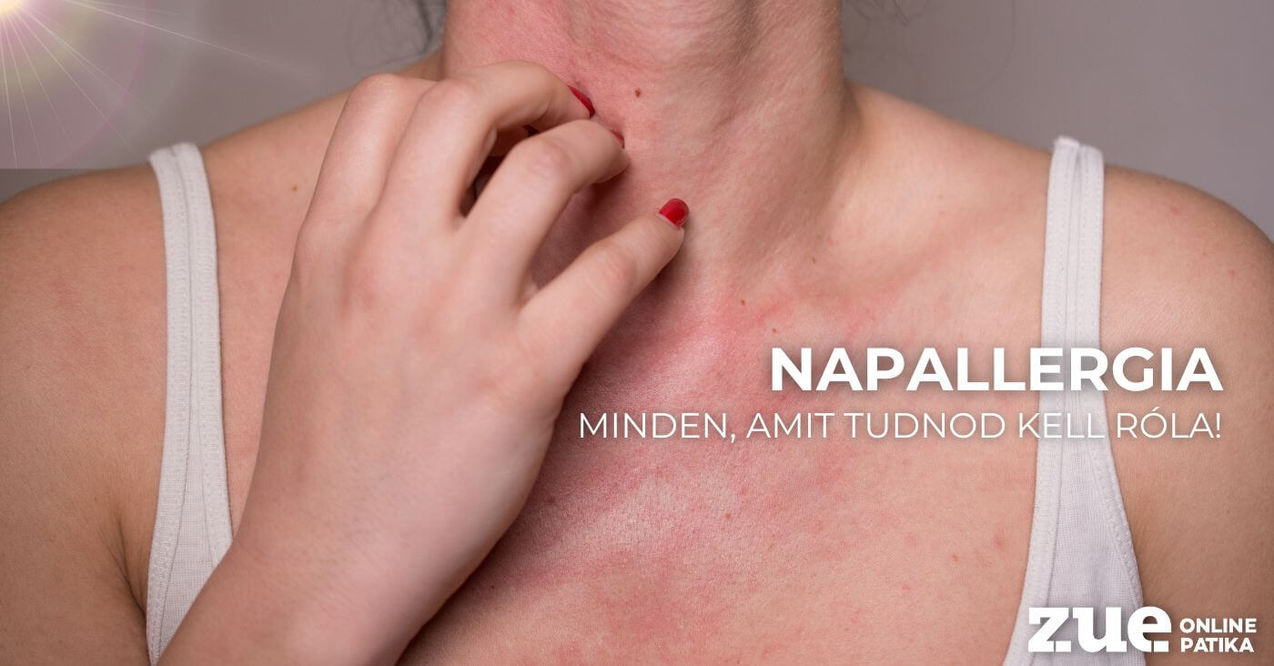 Napallergia – minden, amit tudnod kell róla!